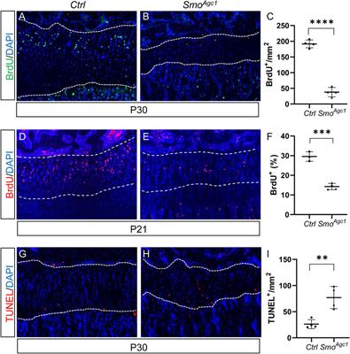 Suppressor of fused-restrained Hedgehog signaling in chondrocytes is critical for epiphyseal growth plate maintenance and limb elongation in juvenile mice